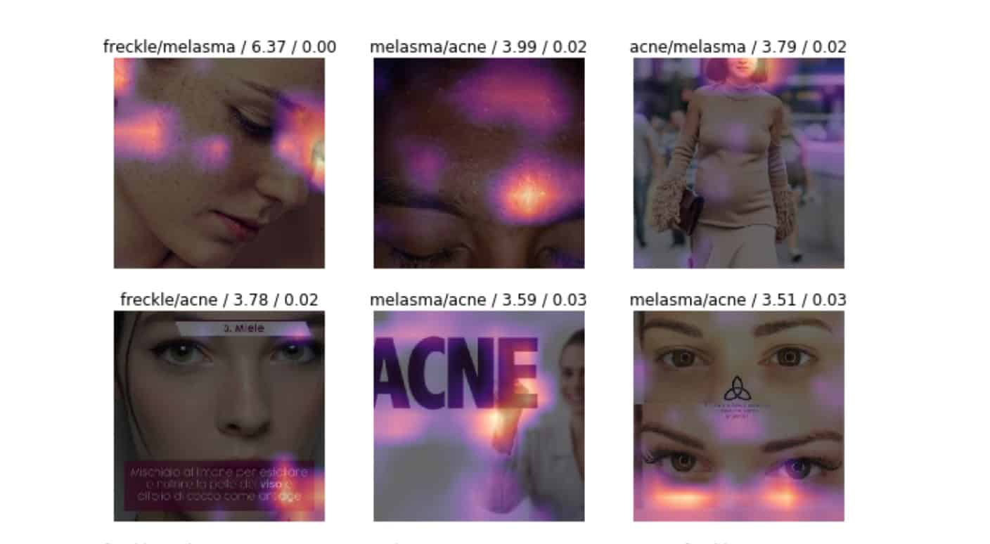 Skin Disease Deep Learning Image Classification. Credit https://www.bualabs.com/archives/530/machine-learning-ai-skin-disease-classification-custom-dataset-how-to-build-model-resnet50-deep-learning-python-image-classification-ep-4/