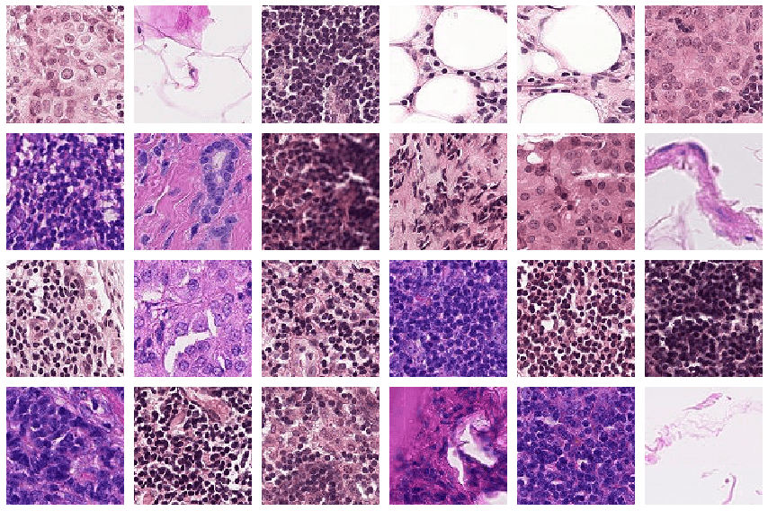 Histopathologic Cancer Detection Identify metastatic tissue in histopathologic scans of lymph node sections. Credit https://www.kaggle.com/c/histopathologic-cancer-detection/data