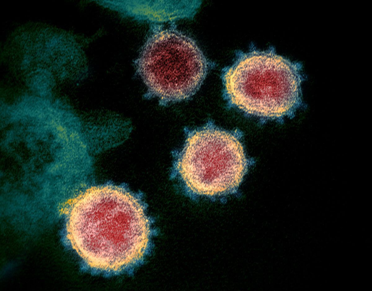 This transmission electron microscope image shows SARS-CoV-2—also known as 2019-nCoV, the virus that causes COVID-19—isolated from a patient in the U.S. Virus particles are shown emerging from the surface of cells cultured in the lab. The spikes on the outer edge of the virus particles give coronaviruses their name, crown-like. Credit https://en.wikipedia.org/wiki/File:SARS-CoV-2_49534865371.jpg