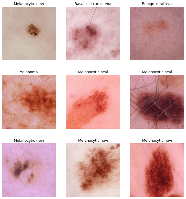 dermatoscopic images pigmented-skin https://www.kaggle.com/kmader/skin-cancer-mnist-ham10000