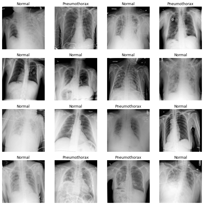 Search Results Web result with site links  SIIM-ACR Pneumothorax Classification Dataset