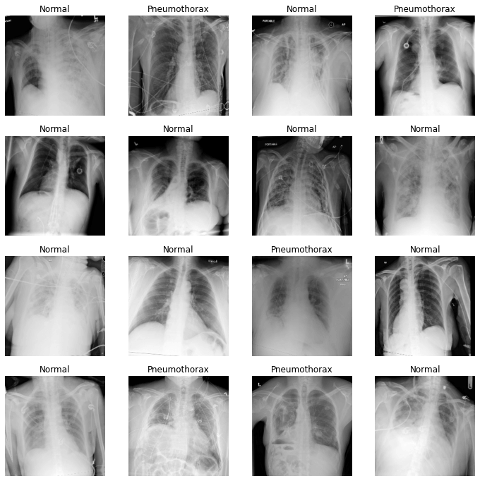 Search Results Web result with site links SIIM-ACR Pneumothorax Classification Dataset