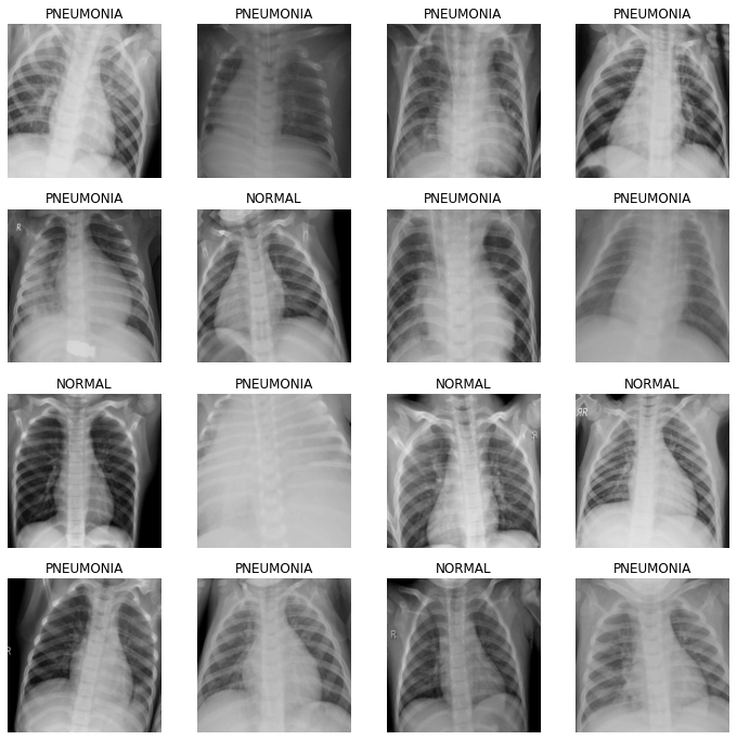 Illustrative Examples of Chest X-Rays in Patients with Pneumonia. Credit https://www.kaggle.com/paultimothymooney/chest-xray-pneumonia