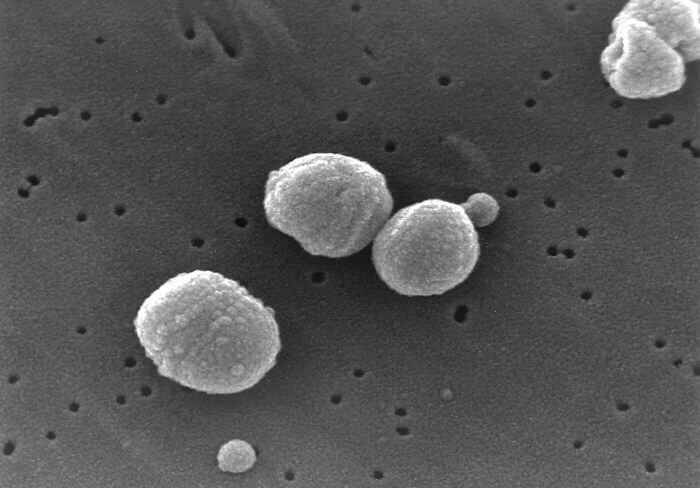 Scanning Electron Micrograph of Streptococcus pneumoniae. Pneumococcus, Streptococci. Credit https://en.wikipedia.org/wiki/File:Streptococcus_pneumoniae.jpg