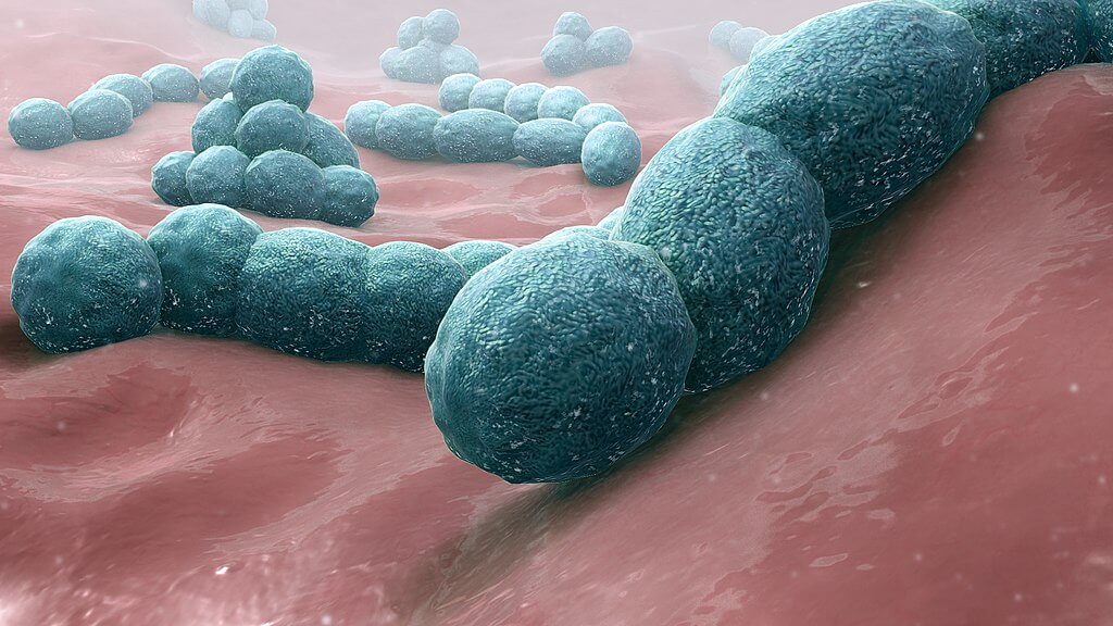 Streptococcus pneumoniae bacteria causes meningitis. Credit https://commons.wikimedia.org/wiki/File:Streptococcus_pneumoniae_-_A_causative_bacteria_of_meningitis.jpg